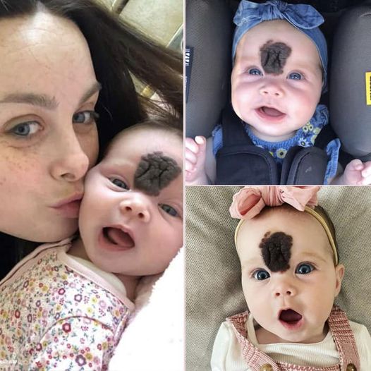 PARENTS KEPT THEIR BABY HIDDEN TO SHIELD HER FROM PEOPLE’S CURIOUS LOOKS. NOW, AT THE AGE OF 2, SHE LOOKS BEAUTIFUL