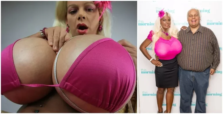 BIGGEST BOOBS Woman who claims to have ‘biggest breasts in Europe’ reveals what she looked like before having plastic surgery