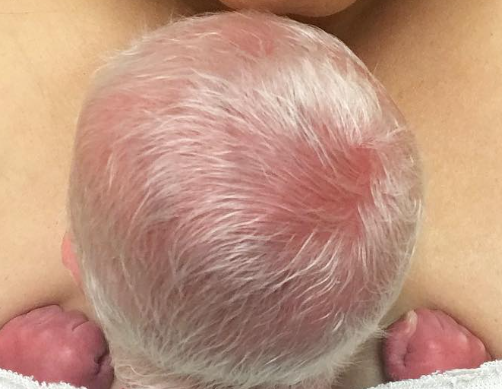 Baby mocked for having white hair – years later, he looks perfectly happy and healthy.