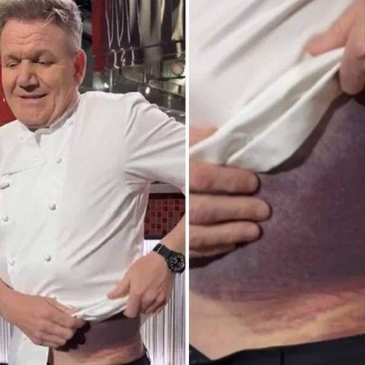 “I’m Lucky To Be Here”: Gordon Ramsay Flooded With Recovery Wishes After Harrowing Accident